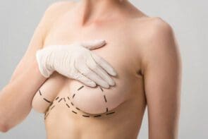 Breast lift
