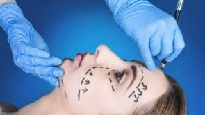 Facelift in Turkey — Types of Procedures, Key Features, and Real Results