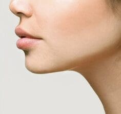 Neck lift