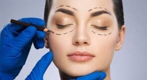 Eyelid lift