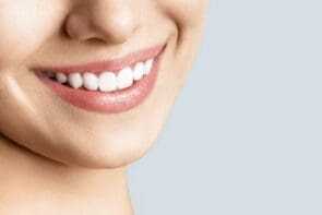 Veneers installation in Turkey