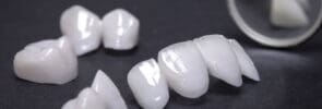 Metal-free Ceramics for Dental Prosthetics