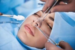 RINOPLASTICS