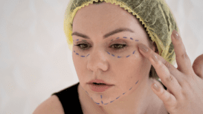Blepharoplasty: How Long-Lasting Is the Result and Who Is This Surgery Suitable For?