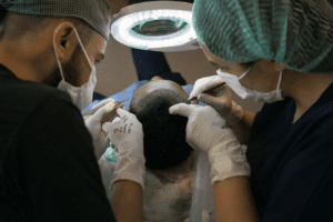 Where Is the Best Place in the World to Get a Hair Transplant?