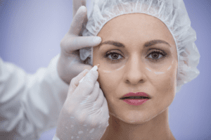Blepharoplasty in Turkey: Top Surgeons, Prices, and What You Need to Know Before Surgery